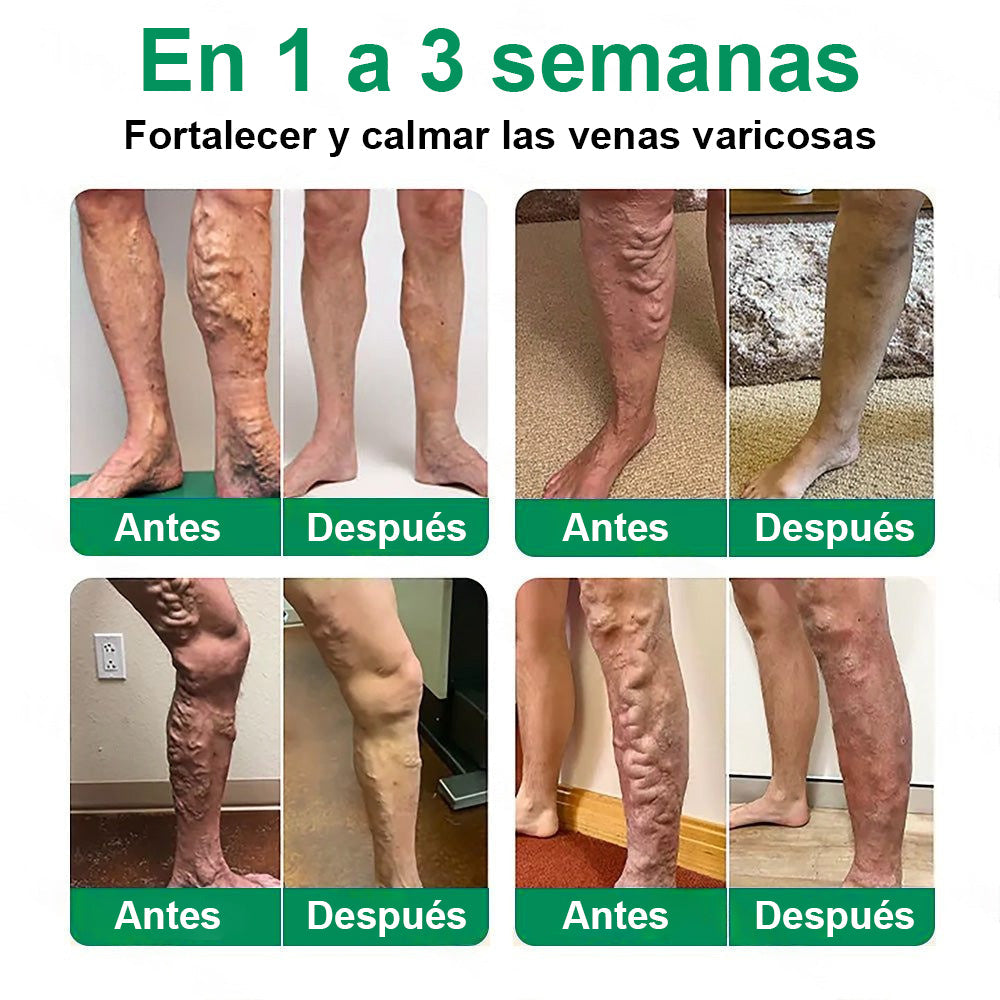 ✨ Healrize® VeinTarget – parche avanzado con microagujas para várices 🔥 96 % de eficacia clínicamente comprobada ✨ Resultados visibles en solo 7–14 días 🌿 Efecto de apoyo suave para piernas más ligeras y relajadas