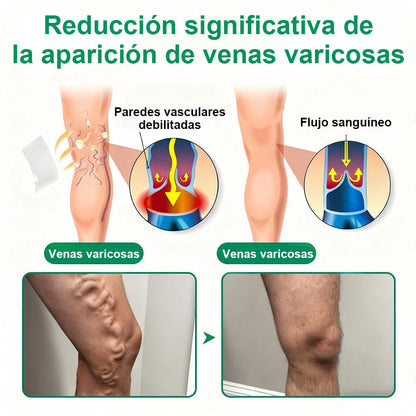 ✨ Healrize® VeinTarget – parche avanzado con microagujas para várices 🔥 96 % de eficacia clínicamente comprobada ✨ Resultados visibles en solo 7–14 días 🌿 Efecto de apoyo suave para piernas más ligeras y relajadas