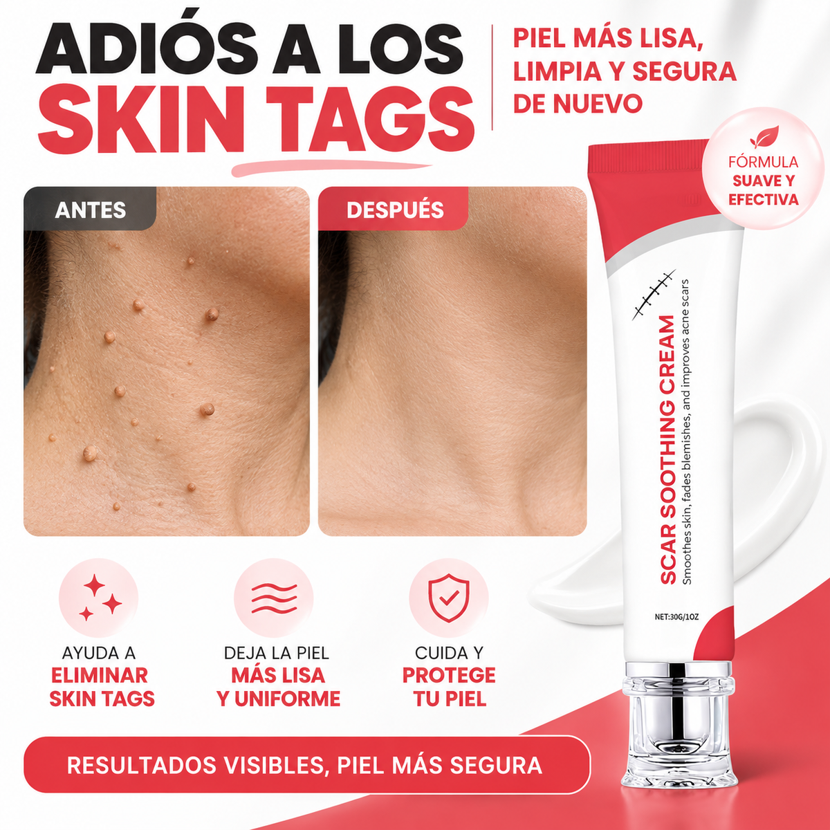 Crema para Skin Tags