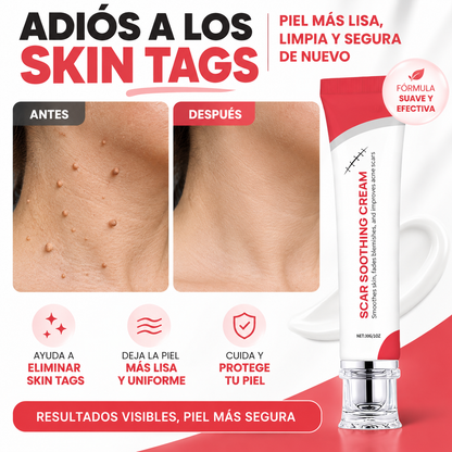 Crema para Skin Tags