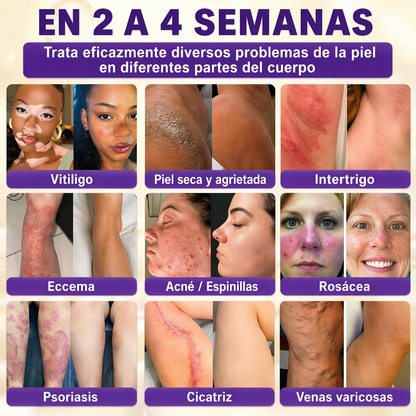 QIAWI® Biotina 10 en 1 Crema Restauradora de la Piel ✨ Resultados visibles en solo 7 días