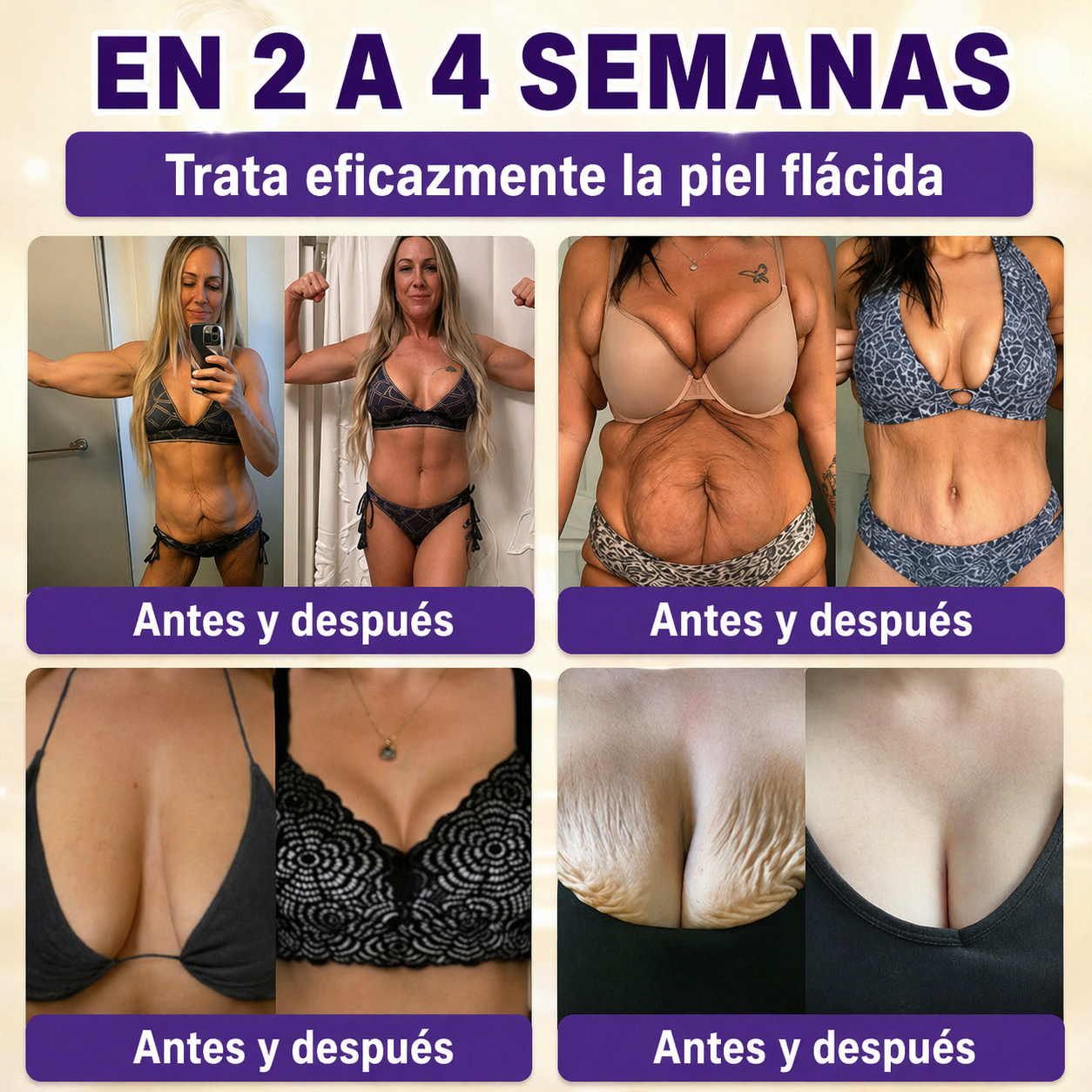 QIAWI® Biotina 10 en 1 Crema Restauradora de la Piel ✨ Resultados visibles en solo 7 días