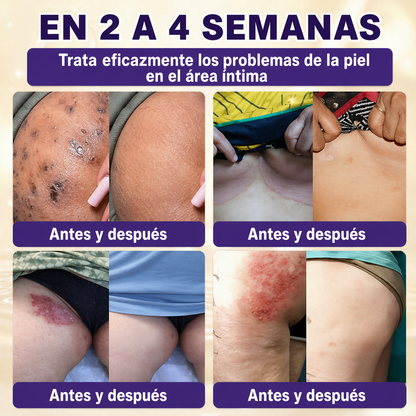 QIAWI® Biotina 10 en 1 Crema Restauradora de la Piel ✨ Resultados visibles en solo 7 días