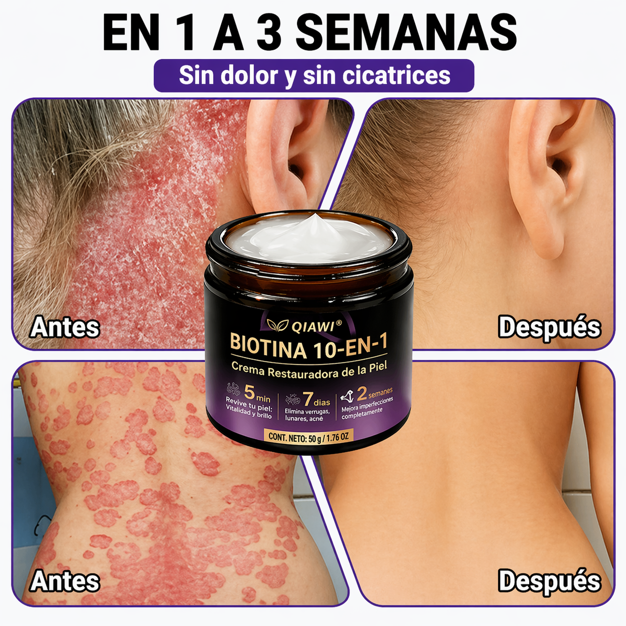 QIAWI® Biotina 10 en 1 Crema Restauradora de la Piel ✨ Resultados visibles en solo 7 días