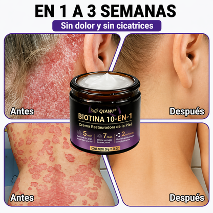 QIAWI® Biotina 10 en 1 Crema Restauradora de la Piel ✨ Resultados visibles en solo 7 días
