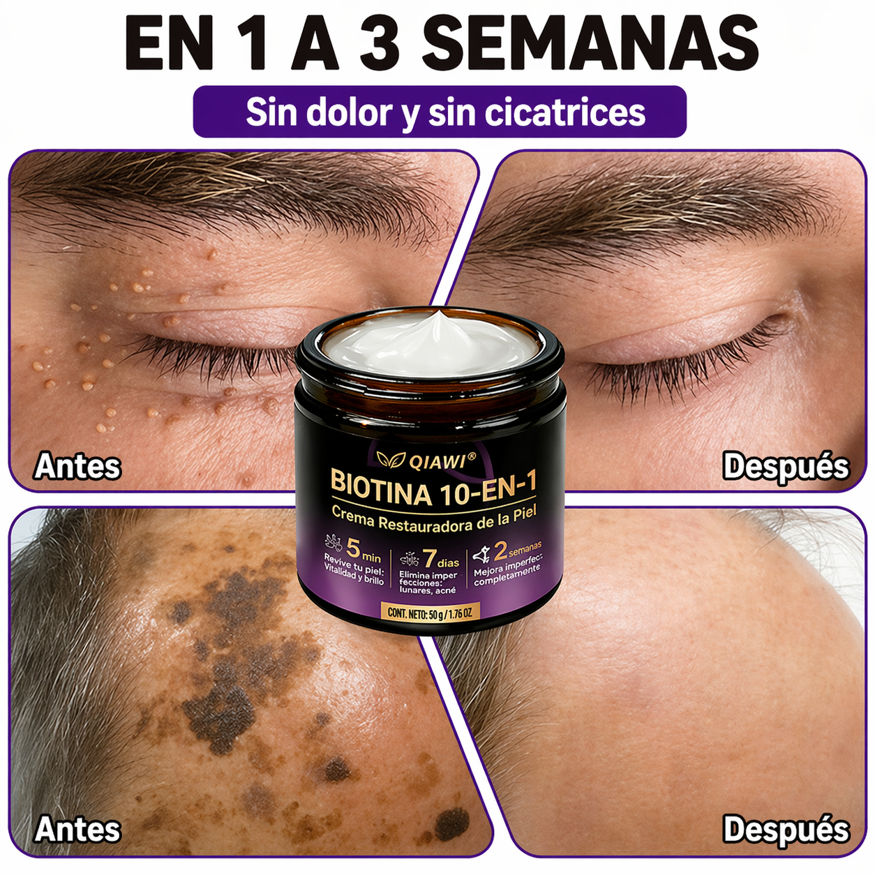 QIAWI® Biotina 10 en 1 Crema Restauradora de la Piel ✨ Resultados visibles en solo 7 días