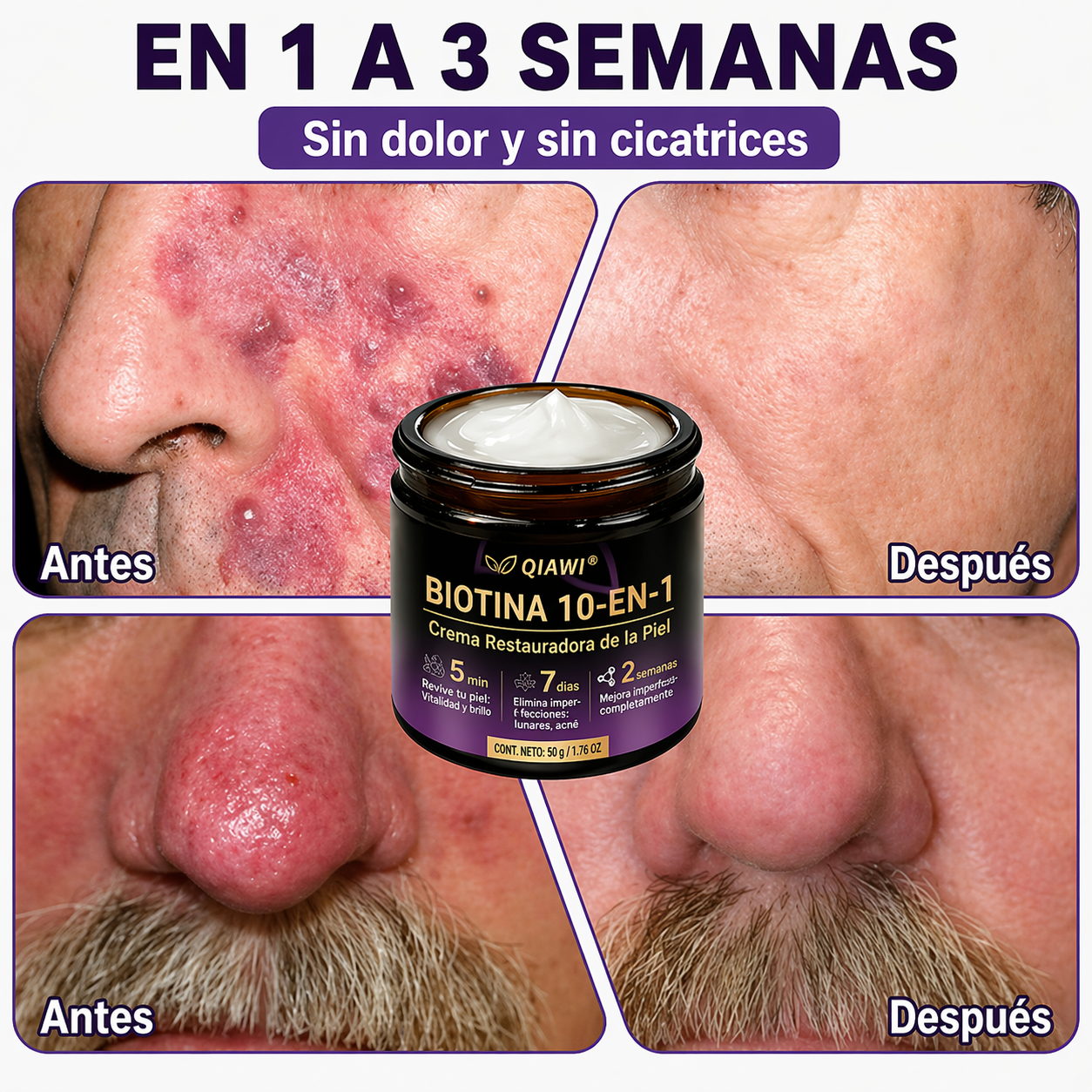 QIAWI® Biotina 10 en 1 Crema Restauradora de la Piel ✨ Resultados visibles en solo 7 días