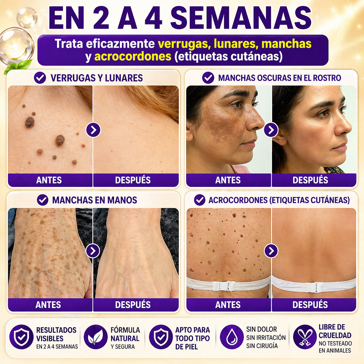 QIAWI® Biotina 10 en 1 Crema Restauradora de la Piel ✨ Resultados visibles en solo 7 días