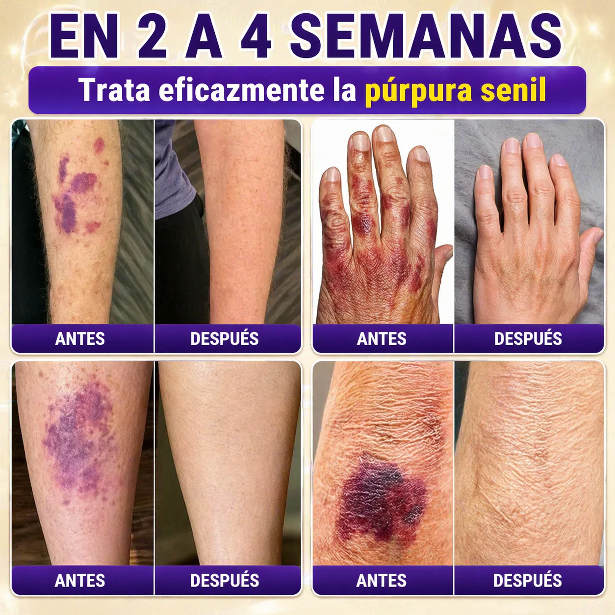 QIAWI® Biotina 10 en 1 Crema Restauradora de la Piel ✨ Resultados visibles en solo 7 días