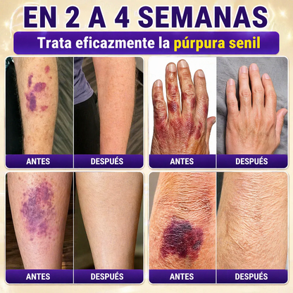 QIAWI® Biotina 10 en 1 Crema Restauradora de la Piel ✨ Resultados visibles en solo 7 días